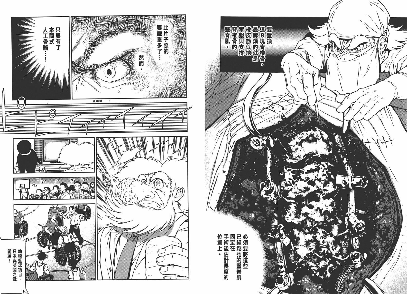 《青年黑杰克》漫画最新章节第4卷免费下拉式在线观看章节第【61】张图片