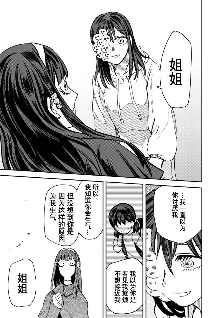 《与面疮相伴》漫画最新章节第49话免费下拉式在线观看章节第【25】张图片