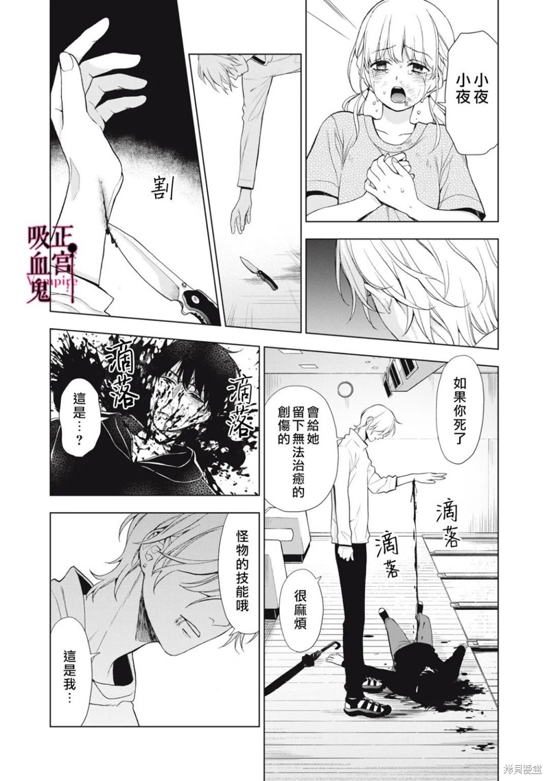 《我的病弱吸血鬼》漫画最新章节第17话免费下拉式在线观看章节第【25】张图片